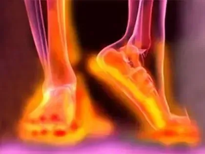 Nervozen pain relief image